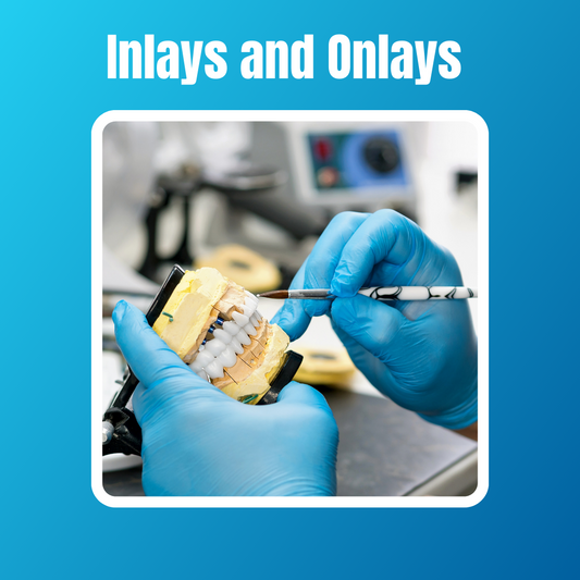 Inlays and Onlays